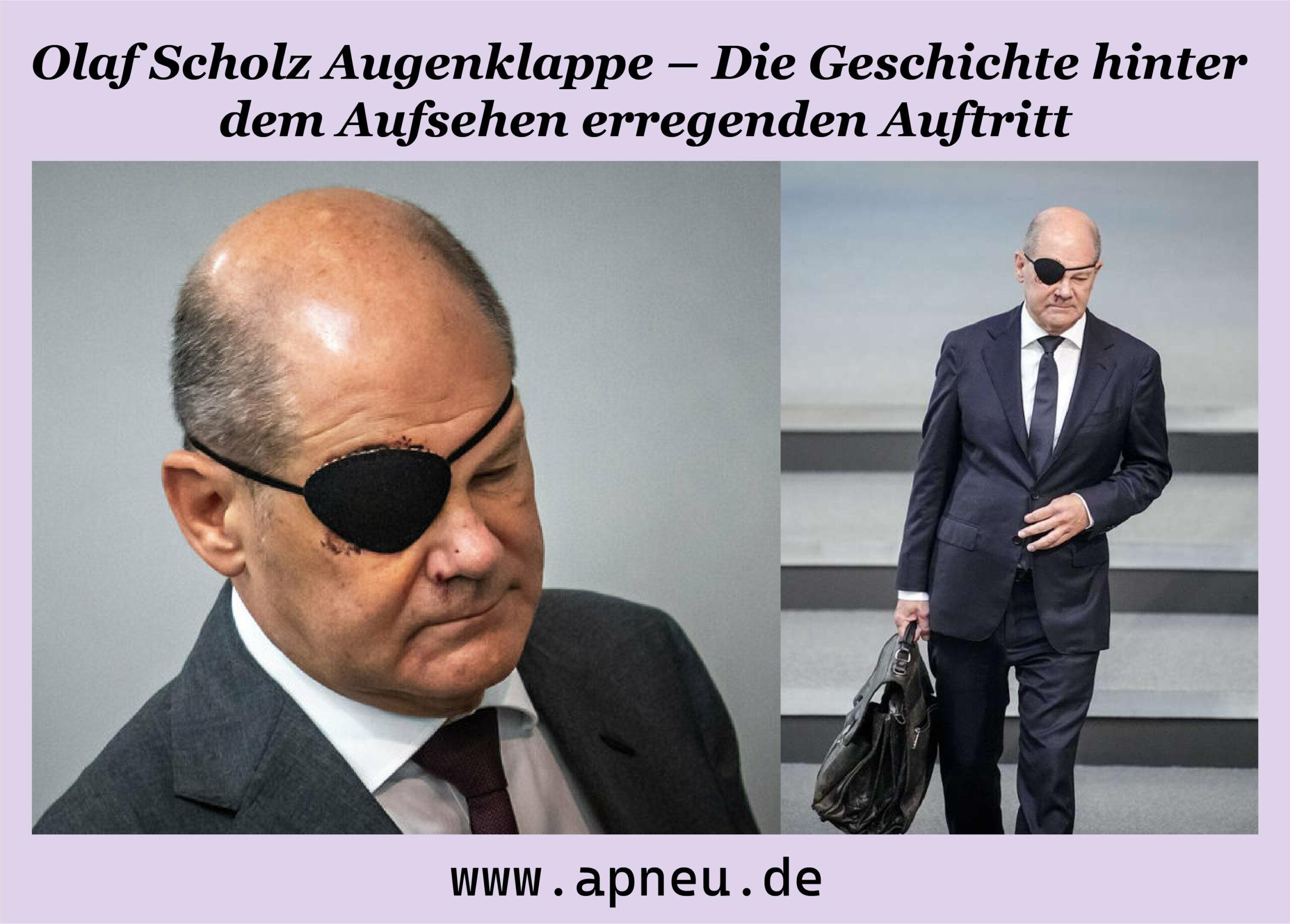 Olaf Scholz Augenklappe – Die Geschichte hinter dem Aufsehen erregenden Auftritt
